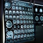 X-Ray and Medical Shredding for Confidential Records in Surrey